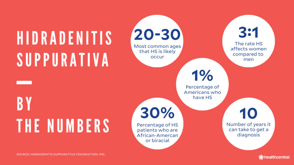 An infographic showing key statistics for Hidradenitis Suppurativa, including the 3:1 female to male ratio and the average 10-year diagnosis time.