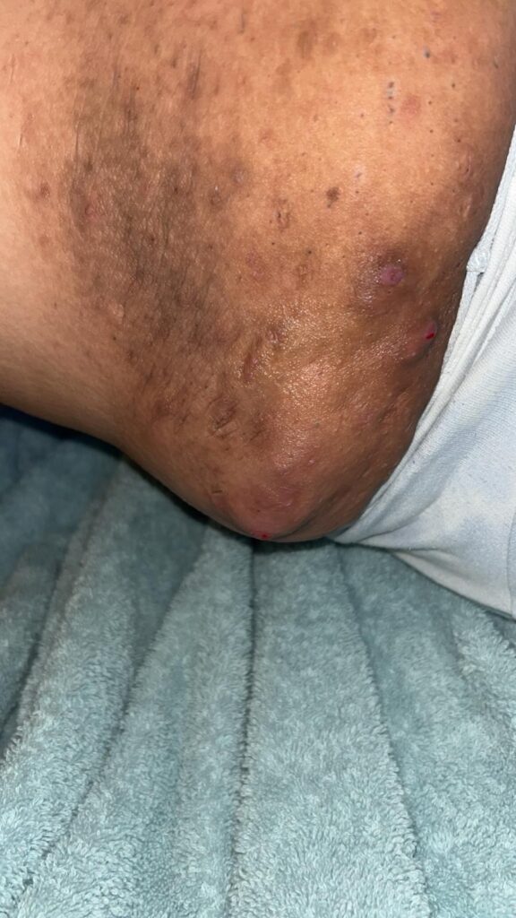 A collection of graphic images showing the reality of Nat