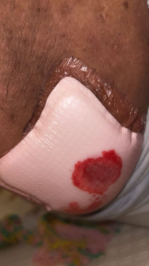 A collection of graphic images showing the reality of Nat