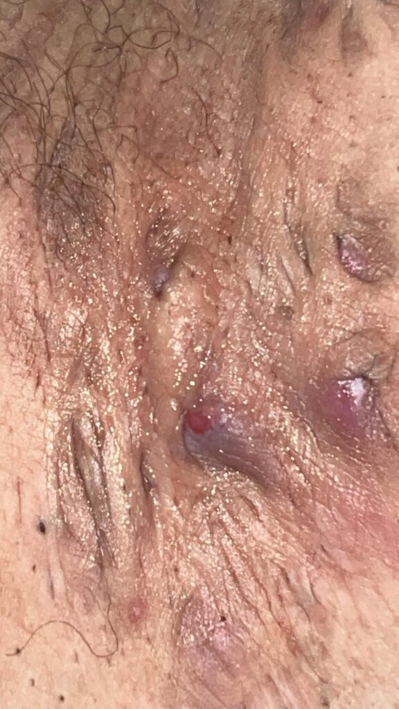 A collection of graphic images showing the reality of Nat